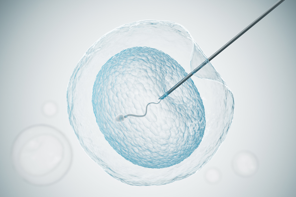 Este procedimiento no solo mejora las posibilidades de fecundación en parejas con factores masculinos severos, sino que también se utiliza en otros contextos para garantizar un resultado exitoso, incluso cuando no existe un diagnóstico masculino grave.